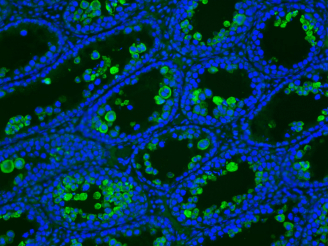 The photo shows that an abundant amount of Zika virus antigens can be found in the testis of a mouse without interferon treatment.